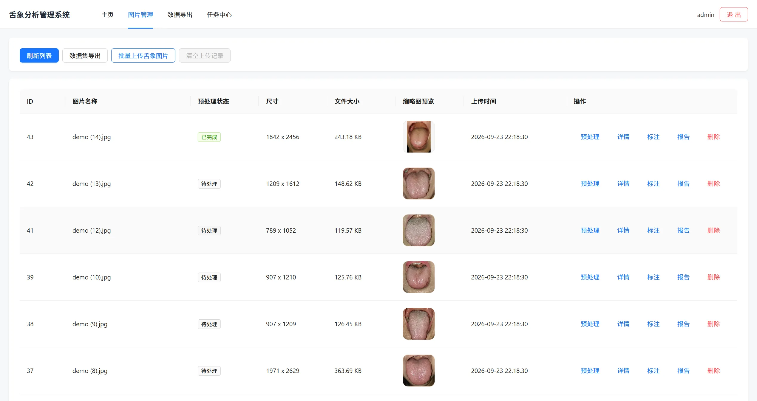 舌象原图批量采集与 OpenCV / Pillow 标准化预处理中台