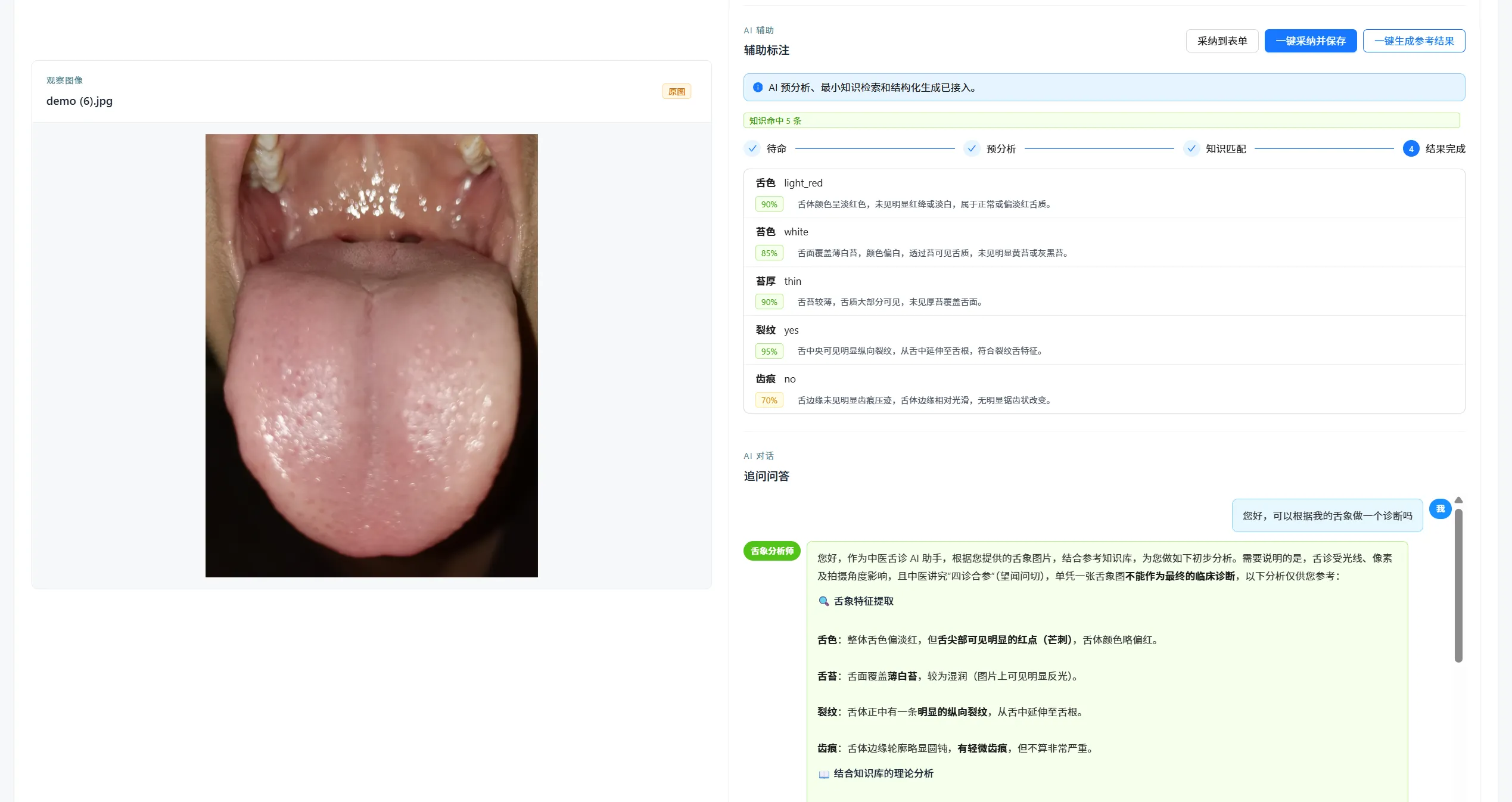 人机混合标注 · 沉淀高质量舌象识别数据集